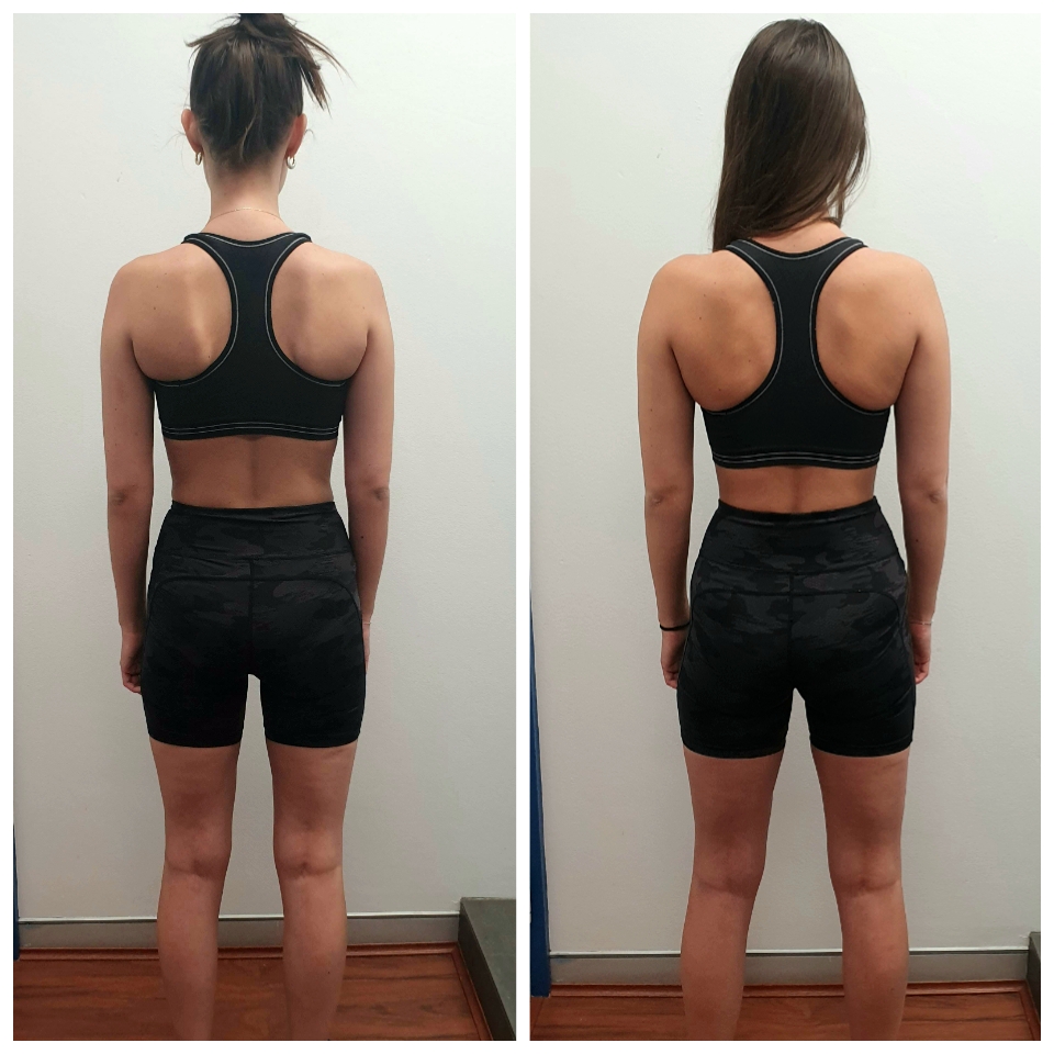 Daniella back-view before and after comparison