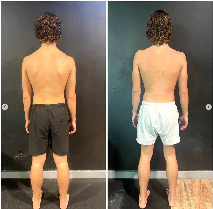 Hugo back-view before and after comparison