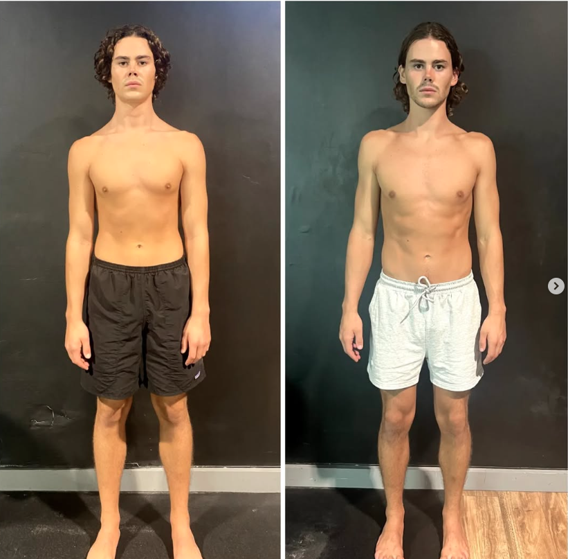 Hugo front-view before and after comparison