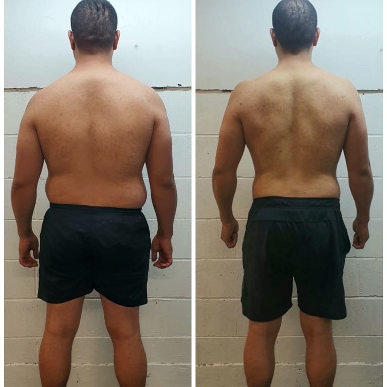 Lio back-view before and after comparison