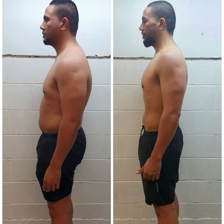 Lio side-view before and after comparison